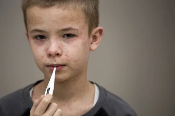 Beteg szomorú fiú gyermek hőmérővel, amelynek láz suf portréja — Stock Fotó