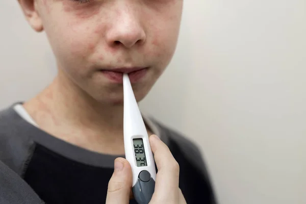 Πορτρέτο του άρρωστο αγόρι λυπημένο παιδί με θερμόμετρο έχοντας πυρετό suf — Φωτογραφία Αρχείου