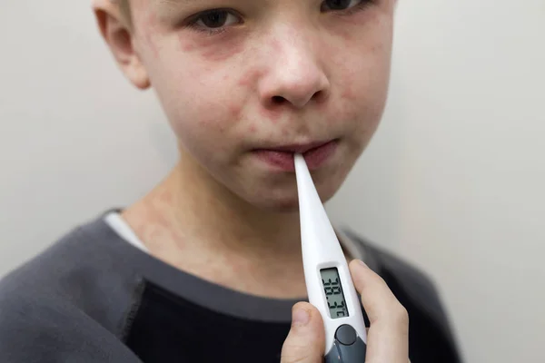 Portrait of sick sad boy child with thermometer having fever suf