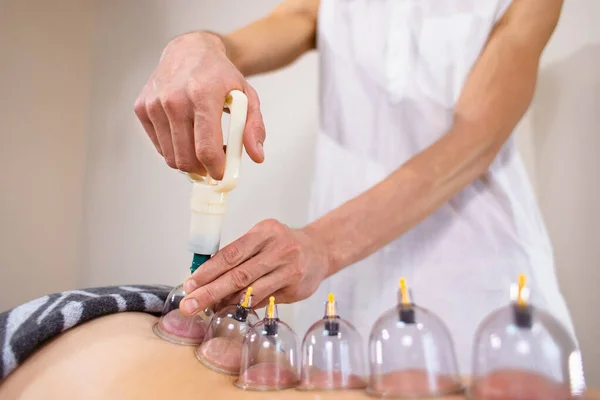 Young woman on the procedure of vacuum cupping massage.