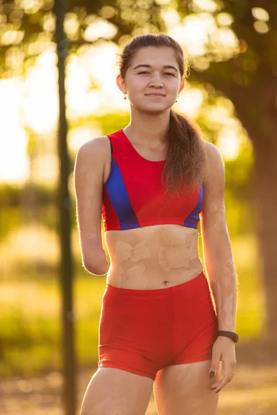 Portrét Mladé Atletky Amputovanou Rukou Popáleninami Těle Venkovní Cvičení Při — Stock fotografie