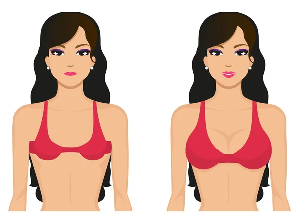 Female breast before and after plastic surgery Stock Vector by  ©jenyakot86.gmail.com 162713518