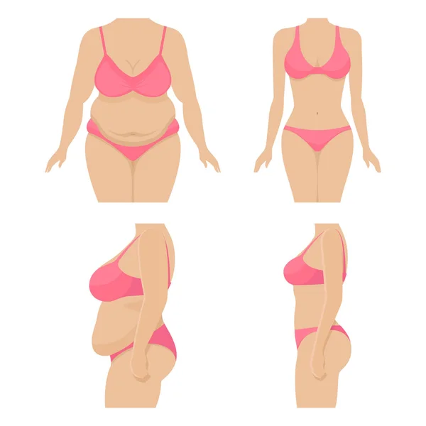 Conjunto de cuerpo de una mujer antes y después de perder peso — Archivo Imágenes Vectoriales