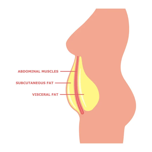 Gordura visceral no corpo feminino com inscrições — Vetor de Stock