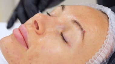 Siyah tıbbi eldivenlerle yakın plan kozmetik uzmanı, kadın yüzünü kozmetik tonik ürünlere batırılmış pamukla siliyor. Kozmetik kliniğinde veya güzellik salonunda cilt bakımı prosedürü