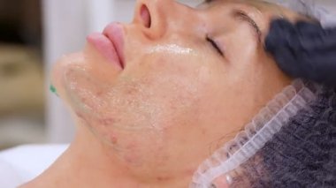 Siyah tıbbi eldivenli kozmetik bilimci kadın yüzüne masaj hareketleriyle kozmetik jel uyguluyor. Kozmetik kliniğinde veya güzellik salonunda cilt bakımı prosedürü.