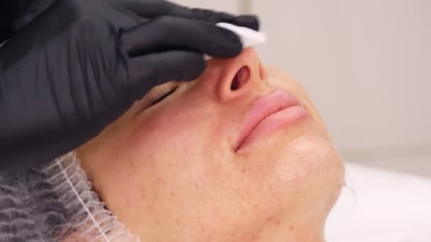 Close-up, kosmetologis, dalam sarung tangan medis hitam, menerapkan tonik untuk wajah perempuan, dengan pad kapas. prosedur perawatan kulit di klinik kosmologi atau salon kecantikan. — Stok Video