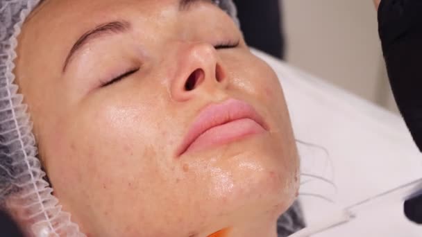 Primo piano, cosmetologo, in guanti medici neri, applica siero cosmetico liquido con pennello speciale al viso femminile. procedura di cura della pelle in clinica cosmetologica o salone di bellezza. — Video Stock