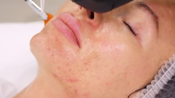 Zbliżenie, kosmetolog, w czarnych rękawiczkach medycznych, stosuje płynne serum kosmetyczne ze specjalną szczotką do twarzy kobiety. zabieg pielęgnacji skóry w klinice kosmetologicznej lub salonie kosmetycznym. — Wideo stockowe