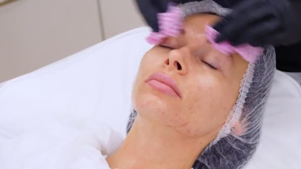 Primo piano, il cosmetologo, in guanti medici neri, toglie resti di prodotto di faccia cosmetico, da faccia femminile con salviettine umide speciali. procedura di cura della pelle in clinica cosmetologica o salone di bellezza. — Video Stock