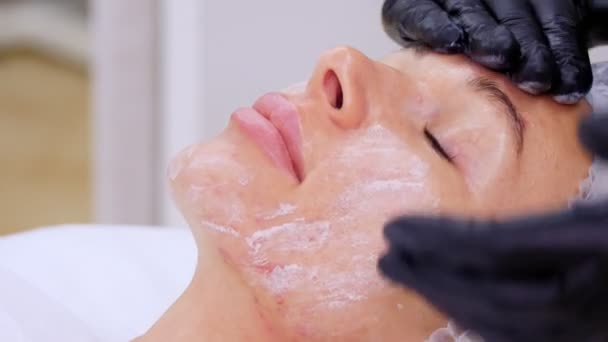 Gros plan, cosmétique en gants médicaux noirs applique uniformément crème cosmétique ou crème solaire sur le visage féminin. soins de la peau, concept de protection solaire. Cosmétologie, salon de beauté. médecine — Video