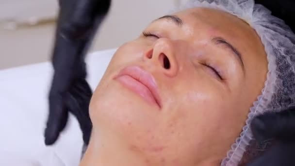 Close-up, cosmetician in black medical gloves applies cosmetic cream to female face with massage movements. skincare procedure in cosmetology clinic or beauty salon. — Stock Video