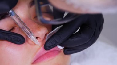 Yakın plan, kadın yüzü. Cerrah, tıbbi eldivenlerle üst kadın dudağına şırınga batırır ve yavaşça hyaluronik asit enjekte eder. Dudak büyütme prosedürü. Estetik ameliyat.