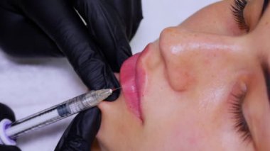 Yakın plan, kadın yüzü. Cerrah, tıbbi eldivenlerle kadının dudağına şırınga batırır ve yavaşça hyaluronik asit enjekte eder. Dudak büyütme prosedürü. Güzellik iğneleri. Estetik ameliyat.
