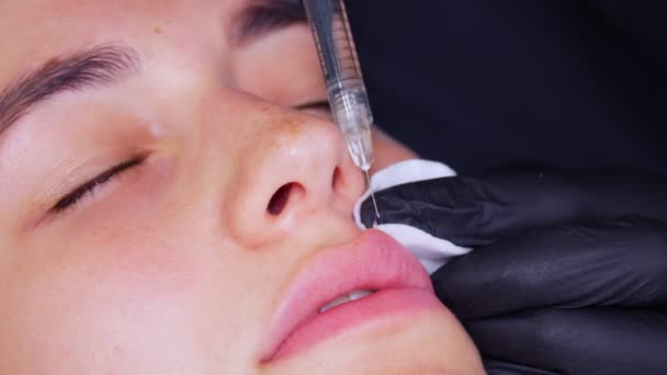 Närbild, kvinnligt ansikte. Kirurg, i medicinska handskar, genomborrar övre kvinnans läpp med spruta och injicerar långsamt hyaluronsyra. Läppförstoringsförfarande. Plastkirurgi. — Stockvideo