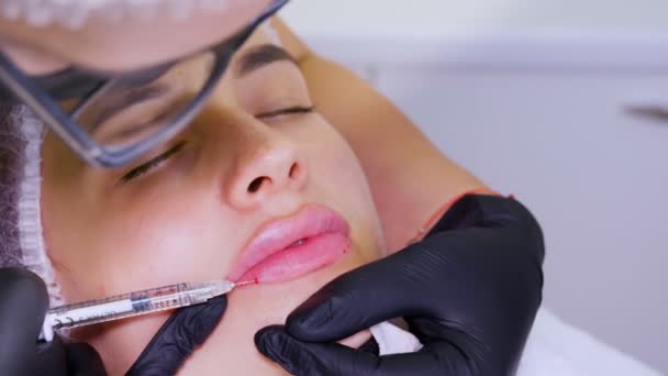 Närbild, kvinnligt ansikte. Kirurg, i medicinska handskar, genomborrar kvinnan läppen med en spruta och injicerar långsamt hyaluronsyra. Läppförstoringsförfarande. Skönhetsinjektioner. Plastkirurgi. — Stockvideo