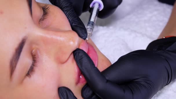 Närbild, kvinnligt ansikte. Kirurg, i medicinska handskar, genomborrar kvinnan läppen med en spruta och injicerar långsamt hyaluronsyra. Läppförstoringsförfarande. Skönhetsinjektioner. Plastkirurgi. — Stockvideo