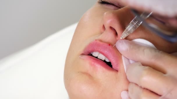 Close-up, female face. Surgeon, in medical gloves, pierces womans lip with a syringe and slowly injects hyaluronic acid. lip augmentation procedure. beauty injections. Plastic surgery. — Stock Video