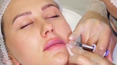 Yakın plan, kadın yüzü. Cerrah, tıbbi eldivenlerde kadının dudaklarına dikkatlice ve yavaşça hyaluronik asit enjekte eder. Dudak büyütme prosedürü. Güzellik iğneleri. Estetik ameliyat.