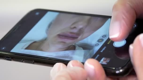 Gros plan du smartphone. Médecin photographie le résultat de son travail sur téléphone portable, procédure d'augmentation des lèvres avec des injections d'acide hyaluronique — Video