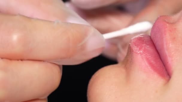 Nahaufnahme, weibliche Lippen. Hand trägt nach Lippenvergrößerung mit Hyaluronsäure-Injektionen mit einem Wattestäbchen beruhigenden Lippenbalsam auf die Lippen auf. — Stockvideo