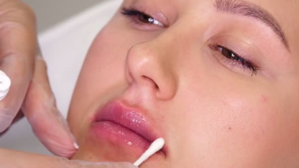 Nahaufnahme, weibliche Lippen. Hand trägt nach Lippenvergrößerung mit Hyaluronsäure-Injektionen mit einem Wattestäbchen beruhigenden Lippenbalsam auf die Lippen auf. — Stockvideo