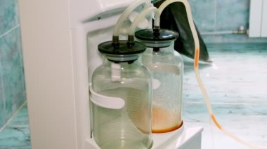 Yakın plan. Karın yağları alınırken hastadan pompalanan yağlar cam şişede, kavanozda toplanır. Liposuction işlemleri için özel tıbbi ekipman.