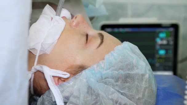 Close-up. female patient, in a state of anesthesia, lies on operating table, against background of Anesthetic monitor, showing patient blood pressure, rhythm and heartbeat, during surgery — Stock Video