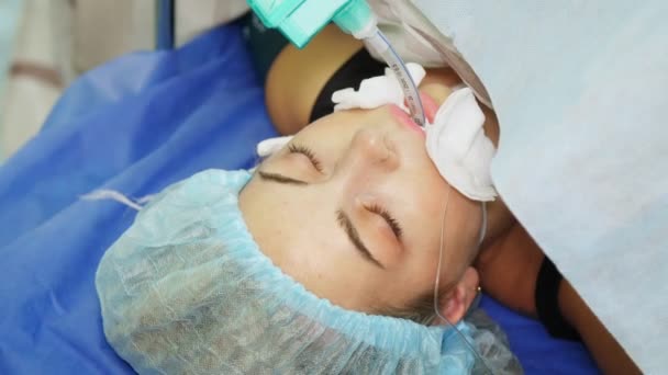 Zbliżenie. pacjentka w stanie znieczulenia, z rurką w jamie ustnej, leży na stole operacyjnym podczas operacji. sala operacyjna i intensywna opieka w szpitalu. liposukcja brzucha. — Wideo stockowe