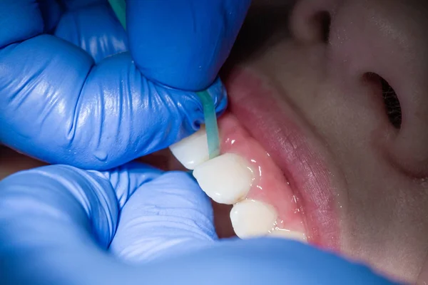 Αγόρι Στο Ραντεβού Τον Οδοντίατρο Εξέταση Στόματος Και Δοντιών Του — Φωτογραφία Αρχείου