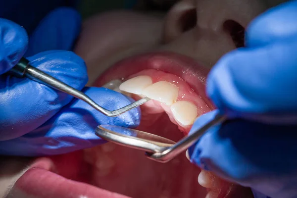 Garçon Rendez Vous Chez Dentiste Examen Bouche Des Dents Enfant — Photo