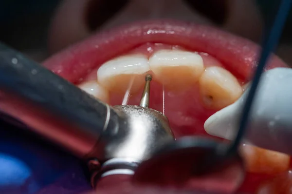 Garçon Rendez Vous Chez Dentiste Examen Bouche Des Dents Enfant — Photo