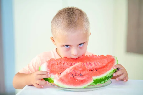 Niño Lindo Con Síndrome Comiendo Sandía Niños Discapacitados Cuidado Personas — Foto de Stock