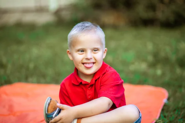 Portrét Malého Roztomilého Chlapce Downovým Syndromem Pečující Nemocné Genetické Onemocnění — Stock fotografie
