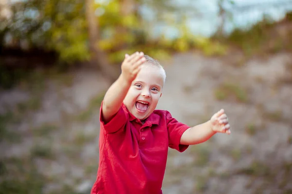 Portrait Little Cute Boy Syndrome Caring Sick People Genetic Disease — Stock Photo, Image