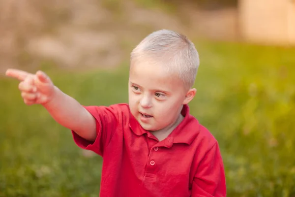 Портрет Маленького Милого Хлопчика Синдромом Дауна Догляд Хворими Людьми Генетичні — стокове фото