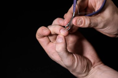 Tırnak hasarı. Tırnaklarını yemiş. Erkek manikürü. Tırnak tabağı sorunları. Erkek eli. Beyaz bir arkaplanda izole edilmiş.