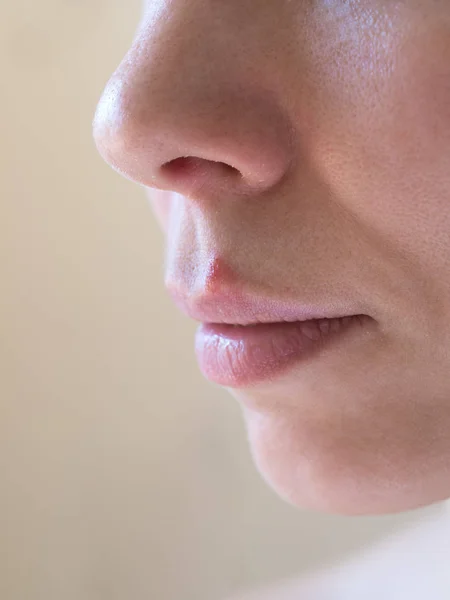 Cold sores. Close-up of the female face, selective focus.