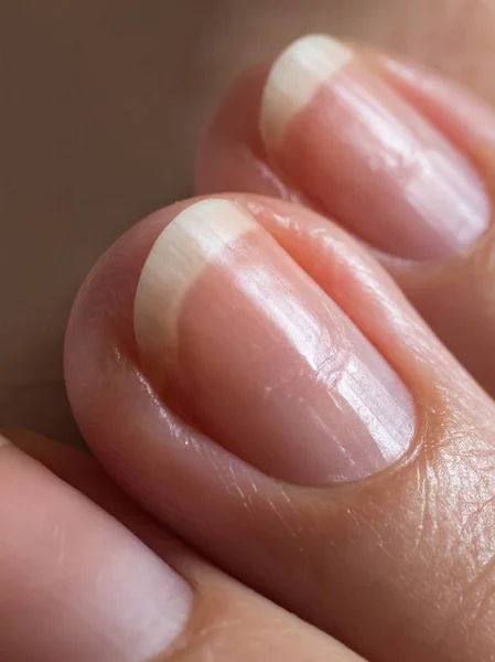 gombák nail osztályozás