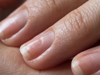 Damaged nails after gel polish. Close up.  clipart