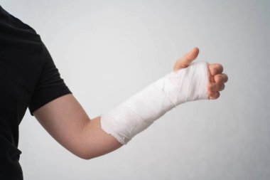 Genç bir adam beyaz bir arka planda alçı bandajlı kırık bir kolun yarasını gösteriyor. Adamın eli kırıktı. Parmaklarını zar zor esnetiyordu.