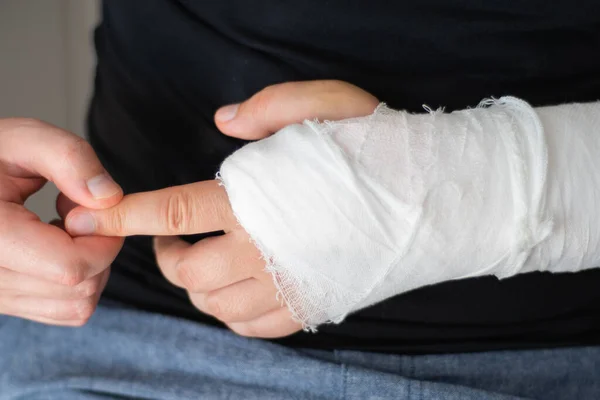 Rehabilitación después de un brazo roto. Un hombre masajea su mano en yeso, de cerca — Foto de Stock