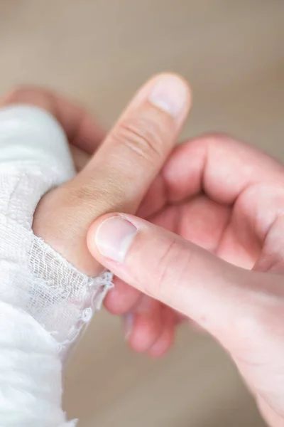 Un brazo roto en yeso flexiona un gran pulgar lesionado de cerca. Compruebe el sistema de propulsión en un brazo de fractura — Foto de Stock