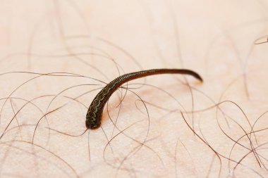 Tropikal arazi sülük / jawed kara sülük (Haemadipsa sp.) insan deriden kan emme. (Güneydoğu Asya, Tayland alınan)