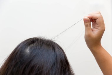 Bozukluk veya trikotilomani genç kadınlar zihinsel sağlık problem içinde çekerek saç.