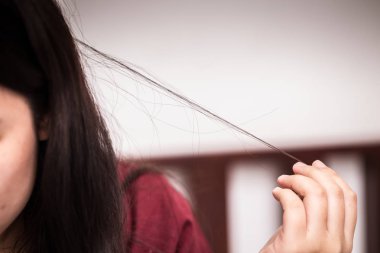 Teen saç bozukluğu ya da trikotilomani ruhsal sorunun stres endişe kız çekerek.