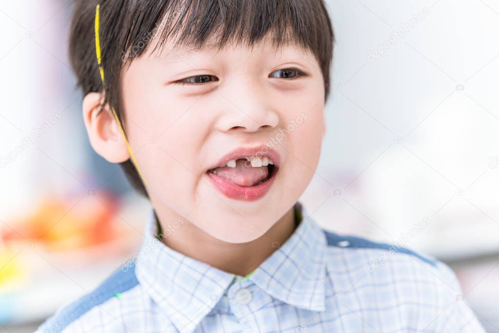 boy lost tooth font. teeth missing in children or dental problem