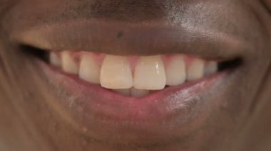 Gülümseyen Dudaklar ve Afrikalı Adamın Dişleri