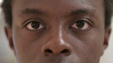 Kırpan Gözler Genç Afrikalı Kameraya Bakıyor