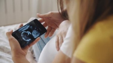 Anneliğin mutluluğu, akıllı telefondan gelecekteki bebeğin ultrason görüntüsüne bakan iki kadın. Eşcinsel hamile lezbiyen çift. Tüp bebek, LBGT Gurur Ayı, ilişki, doğum, konsept.
